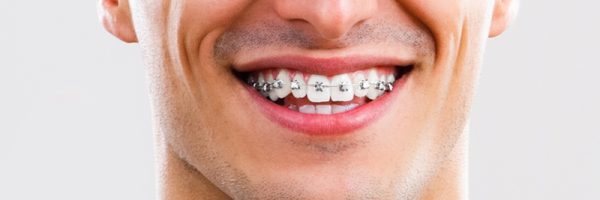 adulte-bague-metal.jpg